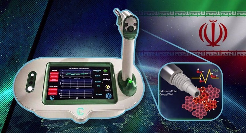 15 Detik yang Menyelamatkan Nyawa: Terobosan Bedah Kanker Pertama di Dunia dari Iran