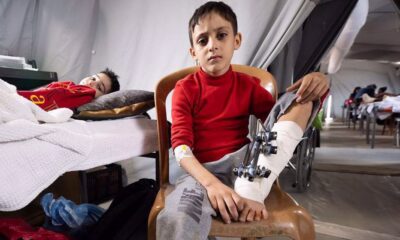 Anak-anak Palestina di rumah sakit lapangan sementara di Jalur Gaza selatan. (Foto Arsip)
